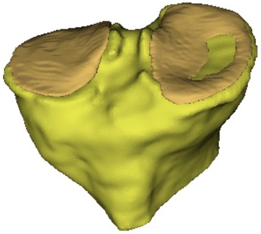 Reconstructed 3D mesh of the distal femur with cartilage.
