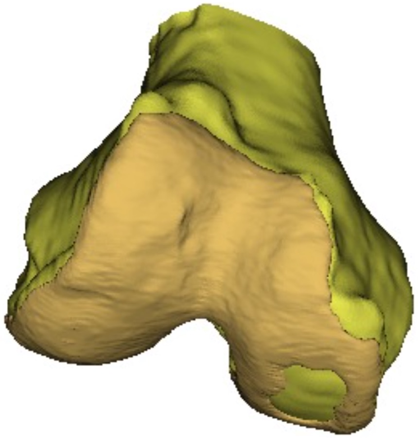 Reconstructed 3D mesh of the proximal tibia with cartilage.